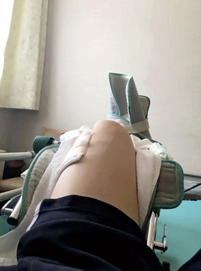 左膝前十字靱帯を断裂し、数カ月のリハビリ生活を送った。しっかりとリハビリすれば必ず戻れるという気持ちを維持していた