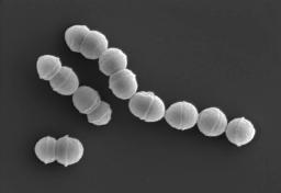 　劇症型溶血性レンサ球菌感染症の主な原因となる「Ａ群溶血性レンサ球菌」（国立感染症研究所提供）