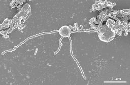 　熊野灘の深海で見つかり、新たな「界」として認められた古細菌（海洋研究開発機構提供）