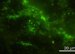 　２０億年前の地層から見つかった微生物。緑色に着色されている（東京大提供）