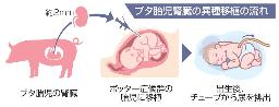 　ブタ胎児腎臓の異種移植の流れ