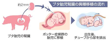 　ブタ胎児腎臓の異種移植の流れ