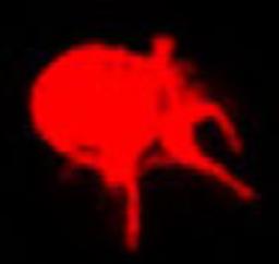 　赤い色を付けたリンパ球系の樹状細胞の顕微鏡画像（東京科学大提供）