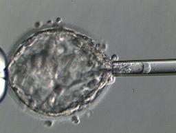 　着床前検査のため受精卵から細胞を取り出す様子（慶応大病院提供）