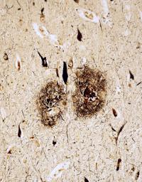 　脳の中にたまった「アミロイドベータ」（中央の二つのだ円形部分）（東京大薬学部提供）